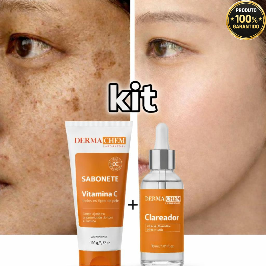 Kit Clareador de Melasma e Manchas – Sabonete Vitamina C + Sérum ...