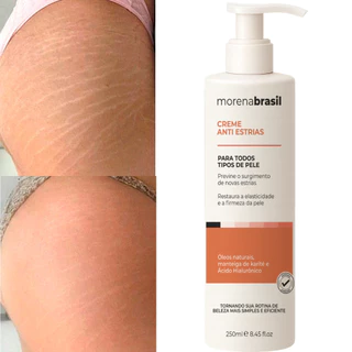 Creme Anti-Estrias Morena Brasil💆‍♀️-  Firmeza e Prevenção de Estrias 🧡 em Oferta na Shopee