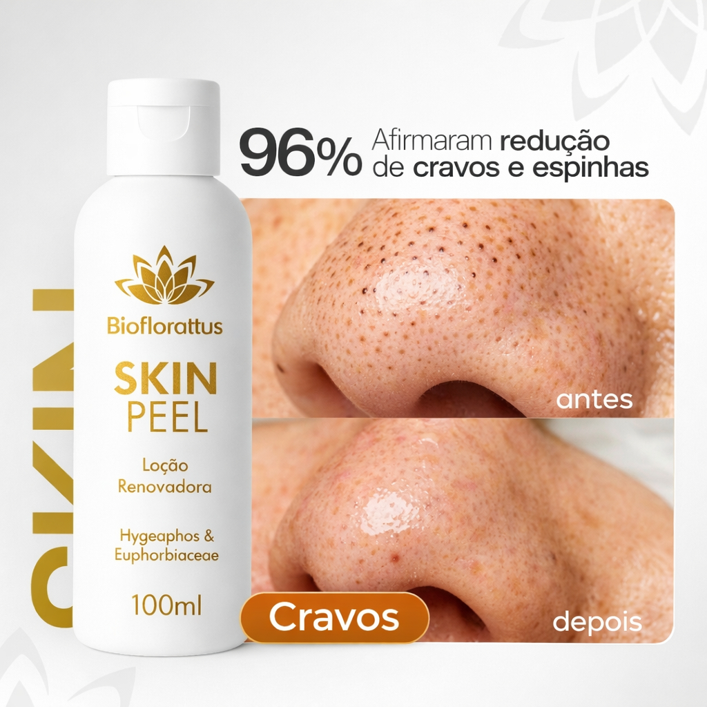 Removedor De Cravos, Espinhas, Controle Da Oleosidade - Skinpeel ...