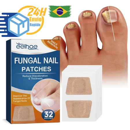 Kit Adesivo Reparador de Unhas dos Pés Cinza Fungo Unha Espessa Correção de Unhas das Mãos Infecção Paroníquia