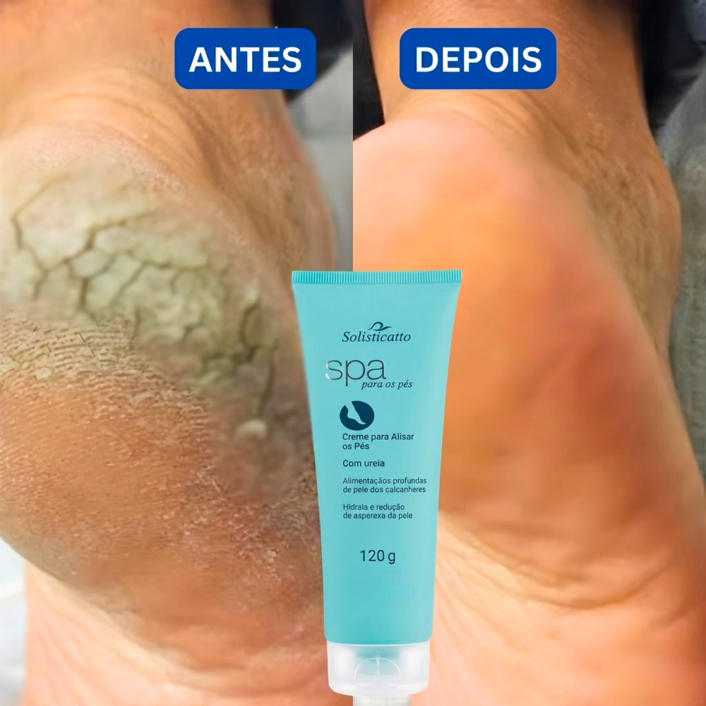 Creme para Pés Rachados Ressecados e Fissurados Spa dos Pés Ureia 10%