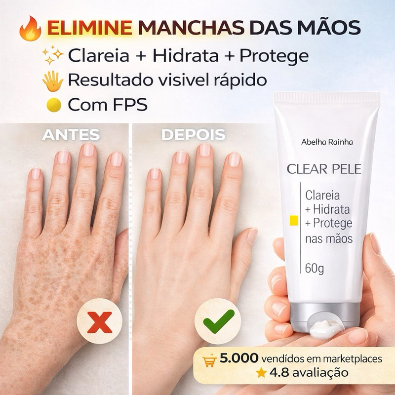 Creme Clareador de Mãos Anti Manchas Senis com FPS | Hidratação ...