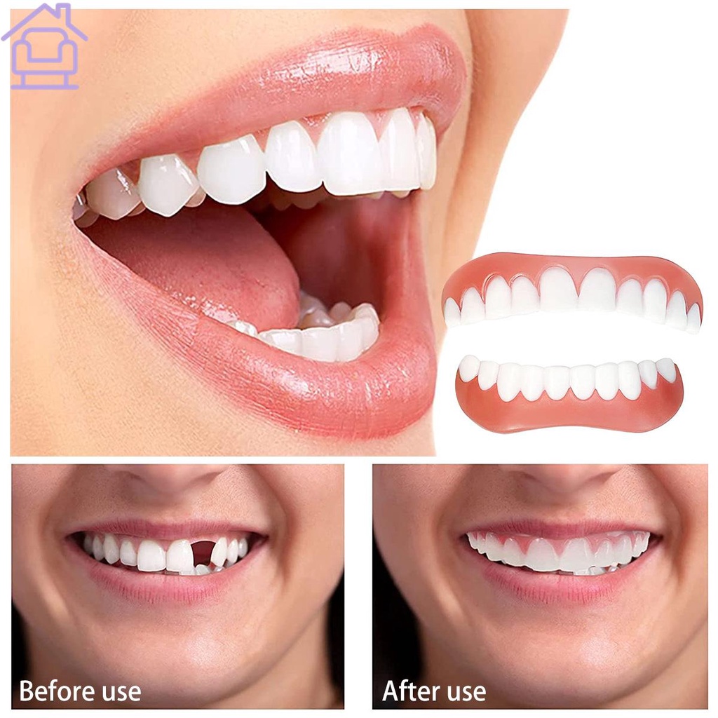 Nova Moda Cosméticos Dentes Perfeito Sorriso Instantâneo Folheados Comfort Fit For Top Falso Dental