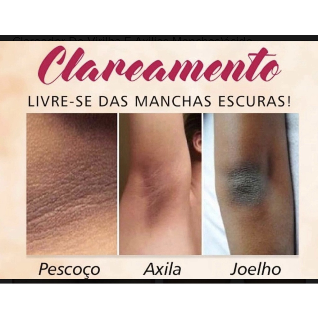 Clareador De Virilhas (livre-se Da Pele Escura) 30ml