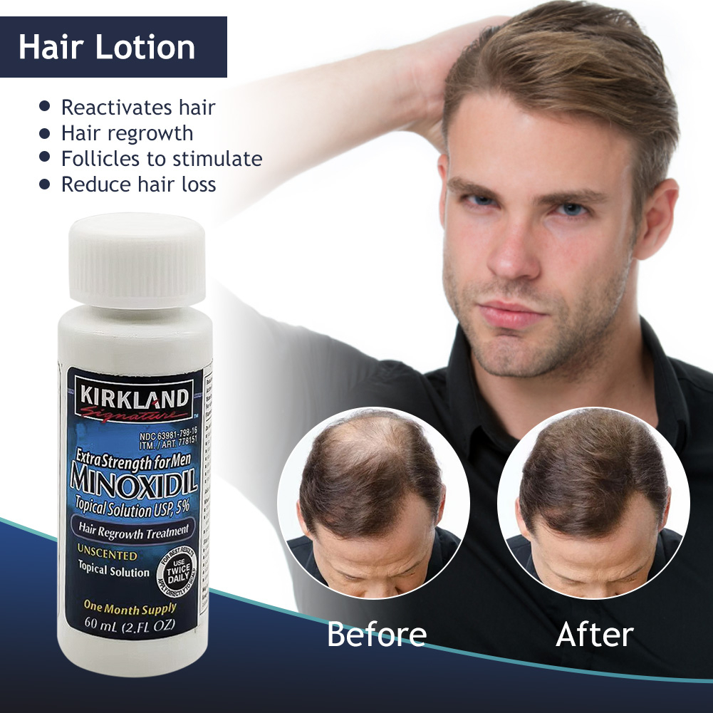 1 PCS Hair Grower Beard Com Conta-Gotas Crescimento Criativo Eficaz Do Cabelo Cuidados A Saúde
