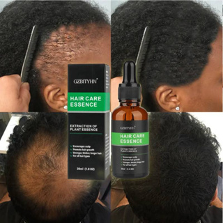 Produtos De Crescimento Rápido De Cabelo Soro Anti Queda Previne A Calvície Tratamento Do Couro Cabeludo Óleos Essenciais Para Cuidados Com Barba Danificada Seco