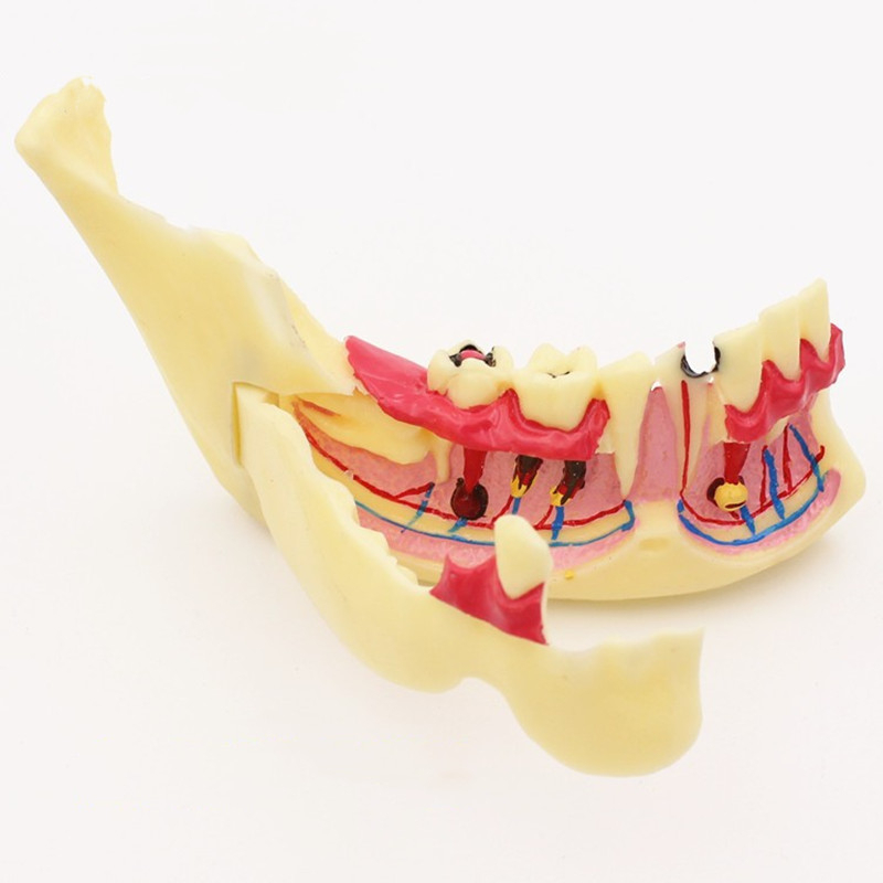 Modelo Anatômico Mandível De Tratamento Endodôntico Dentário Anatomia Do Tecido Das Gengivas Estudo Odontológico De Ensino Oral Dos Dentes
