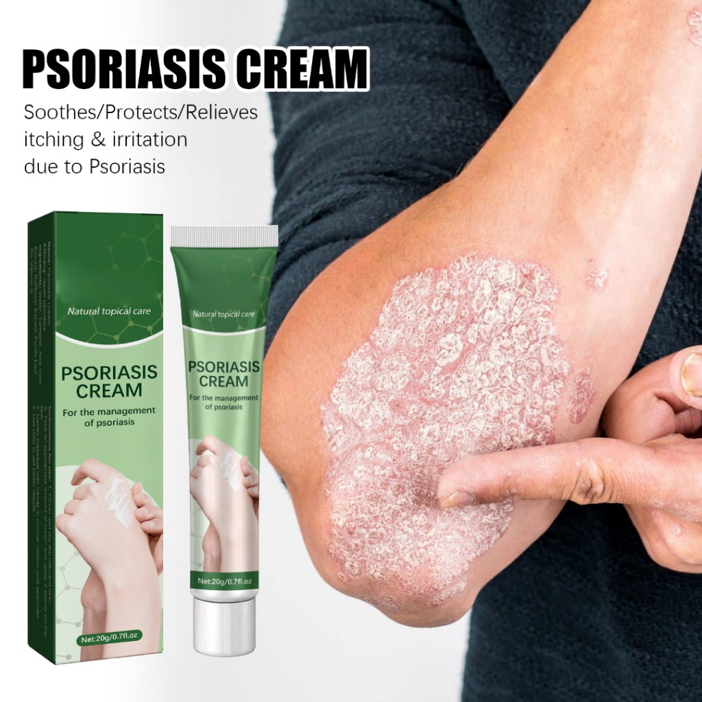 20g Pomada Anti-Itch Psoríase Dermatite Pruritus Creme De Tratamento ...