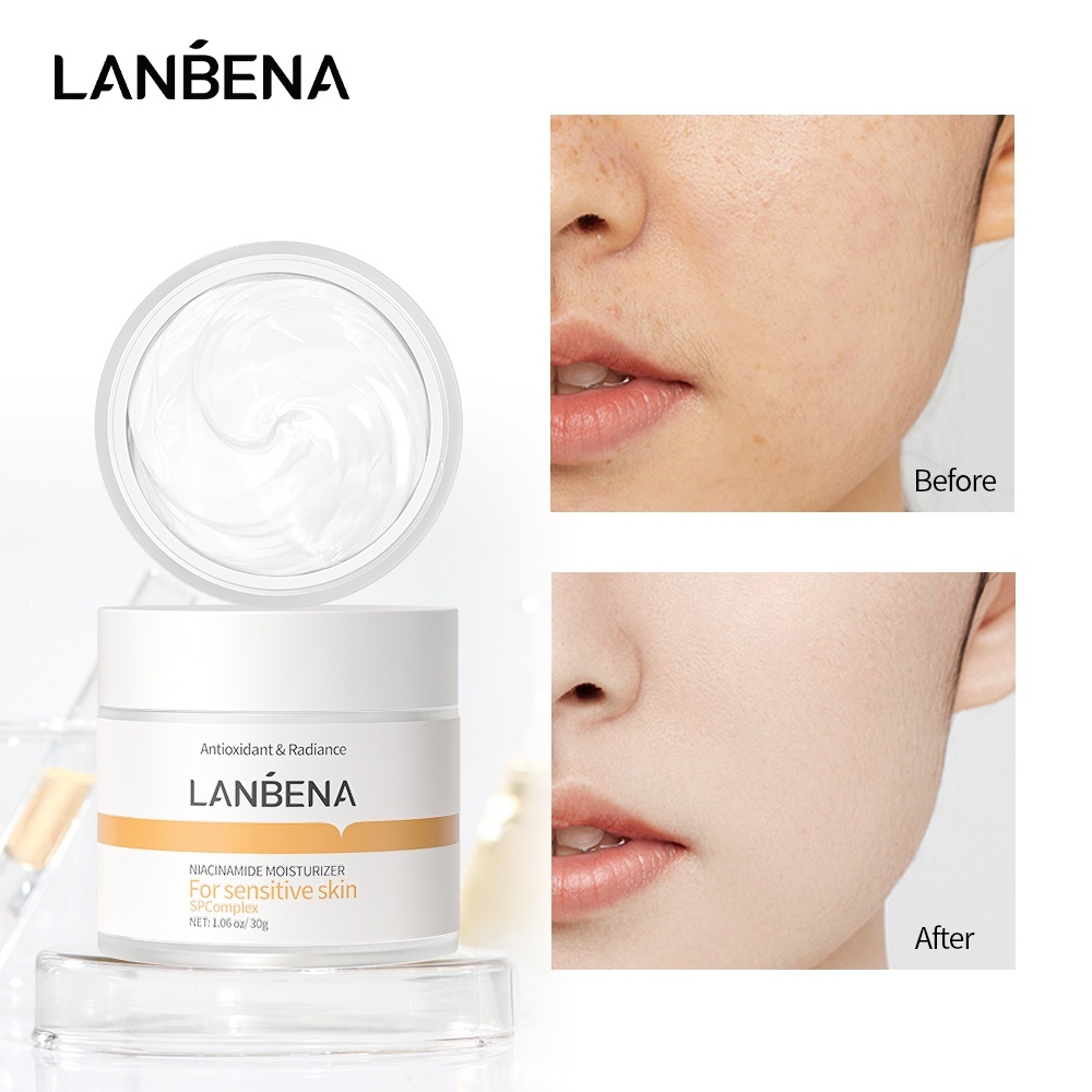 LANBENA Creme Hidratante Facial Niacinamida Vitamina B3 Clareador ...