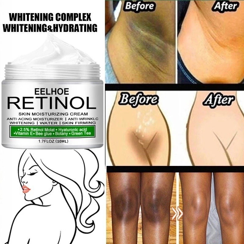 Creme Branqueador Corporal Peças Particulares Soro Para Axilas Joelho Brilhante Coxa Interna Escura Remover Melanina