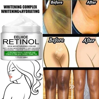 30ml/20ml Creme Branqueador Corporal Peças Particulares Soro Para Axilas Joelho Brilhante Coxa Interna Escura Remover Melanina