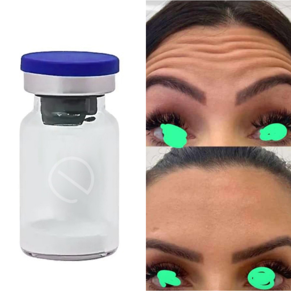 E Tampa Azul 100 150 200 Unidade Essência de Remoção de Rugas em Pó 7ml