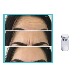 Essência Facial Hidratante 100U 150U 200U