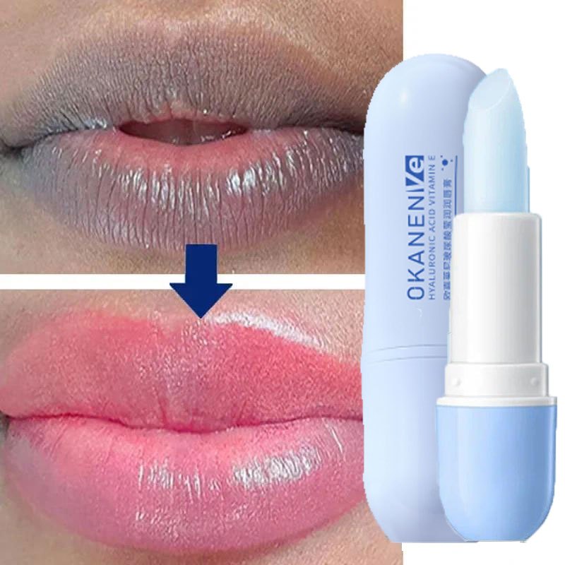 Bálsamo Labial Remover Pigmento Escuro Clareador Creme Hidratante Ácido Hialurônico Esfoliante Pele Morta Branqueamento Beleza Cuidados Com A Saúde