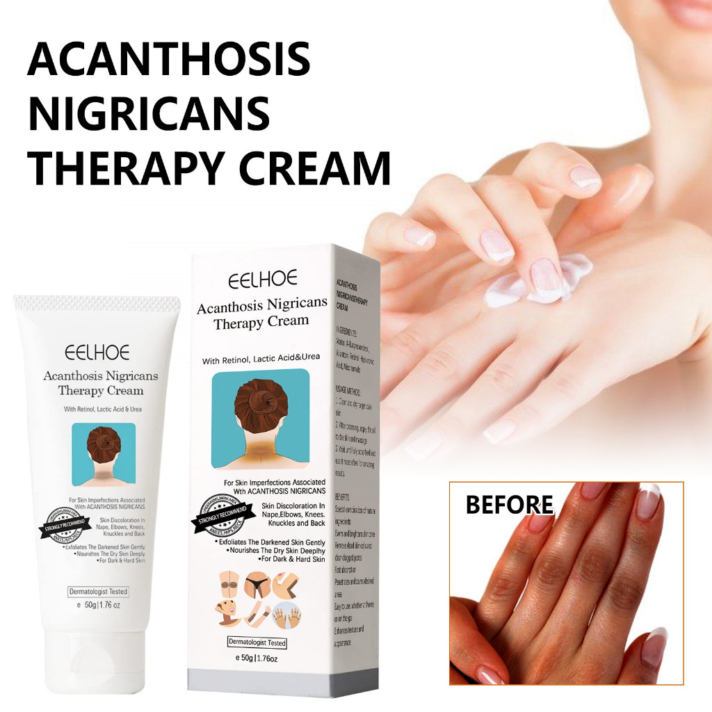 EELHOE 50g Fixderma Nigrifix Creme De Tratamento Nigricans Soro