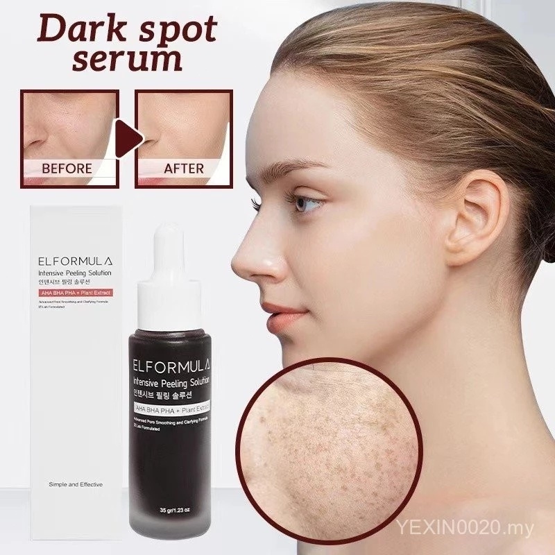 ELFORMULA Solução Intensiva Peeling AHA BHA PHA Soro Esfoliante Manchas ...