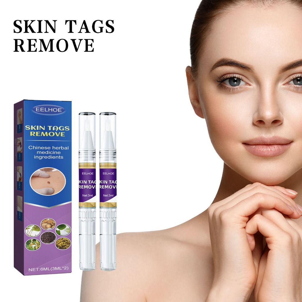 Removedor De Verrugas Creme original watson anti Marcas De Pele E ...