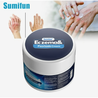 Sumifun Eczema Cream 50g, Anti-Itch Psoriasis Dermatitis Ointment ...