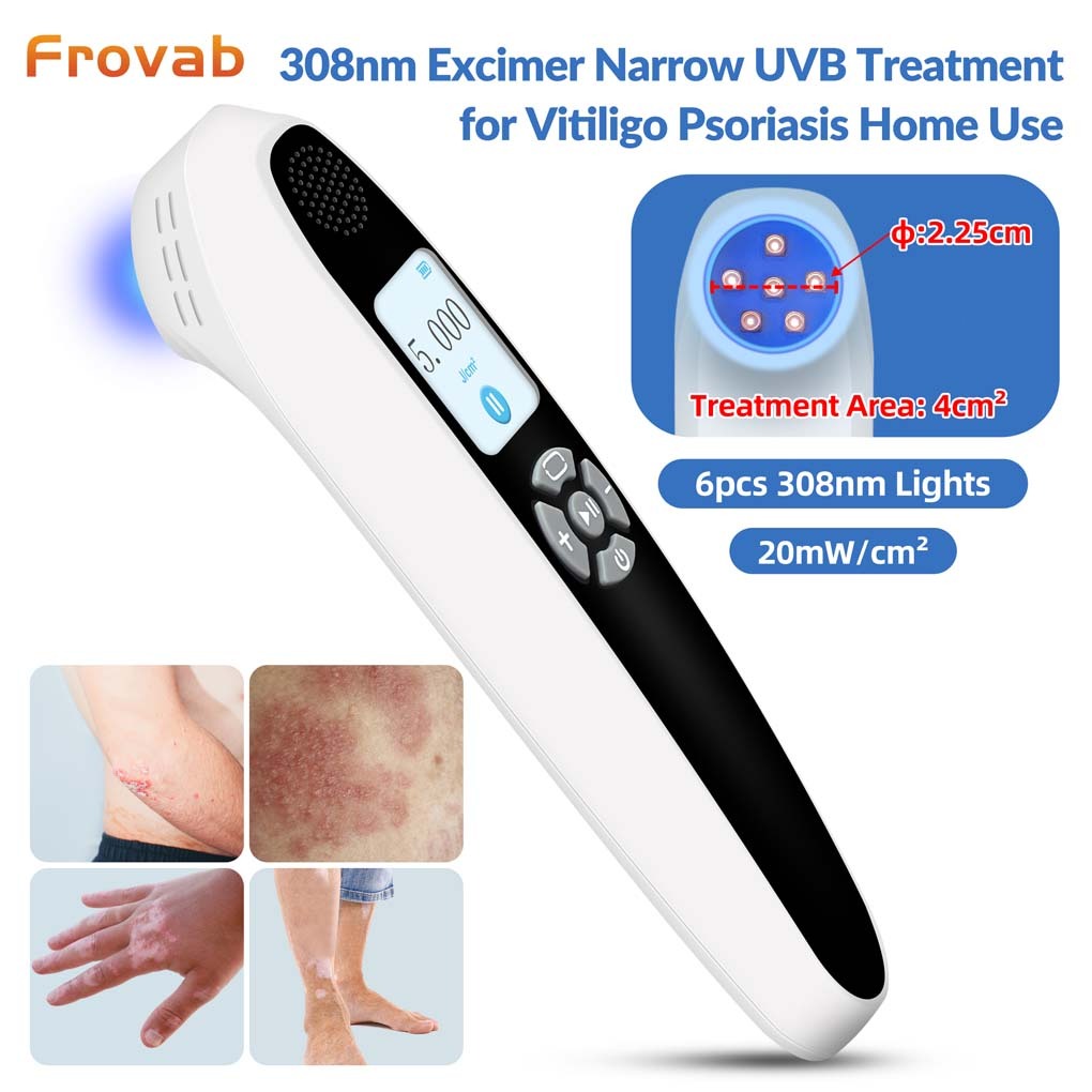 Terapia De Luz De Lâmpada De Fototerapia De Excimer UV De 308nm Para ...