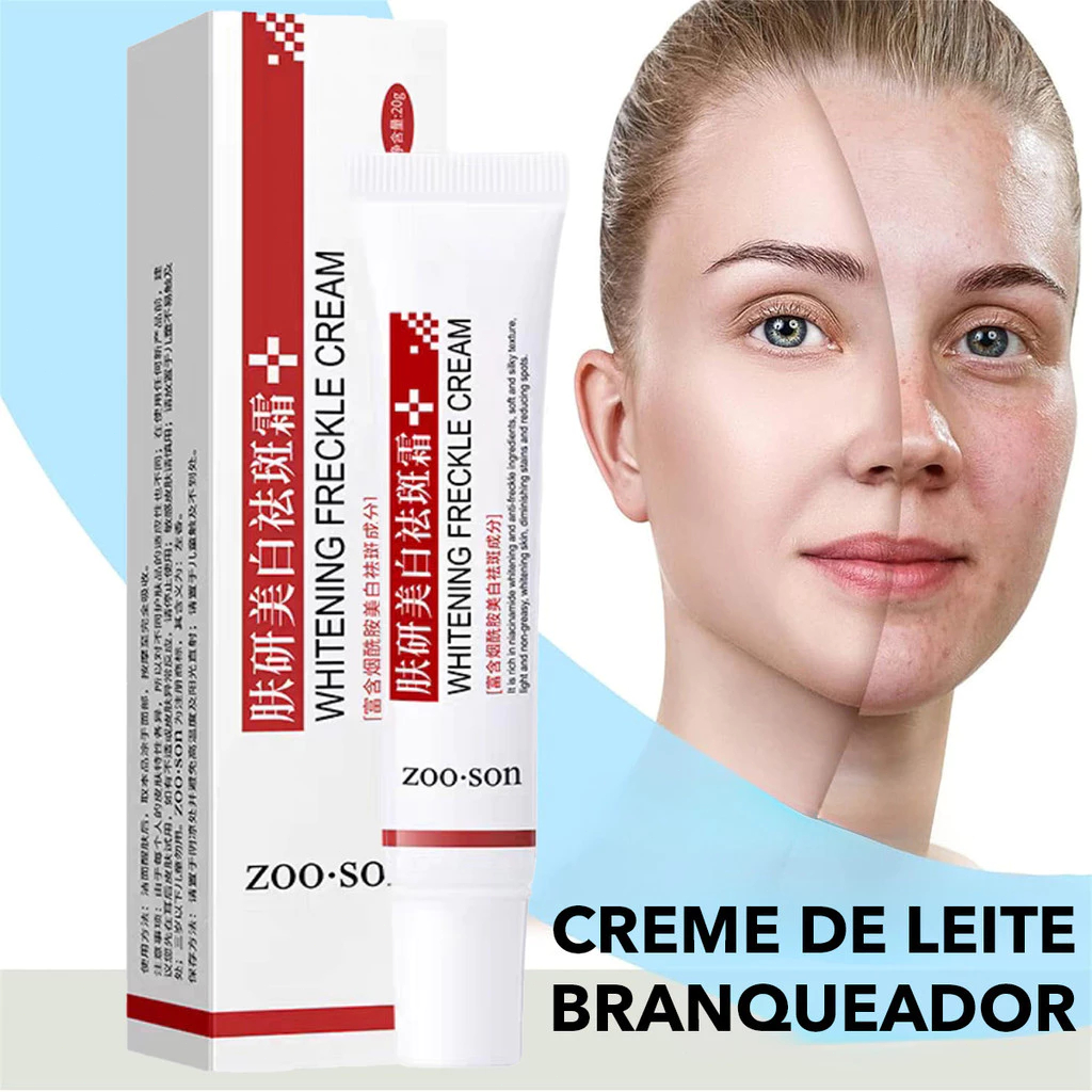 Creme Clareador Para Remover Melasma/Melanina/Removedor De Pele ...