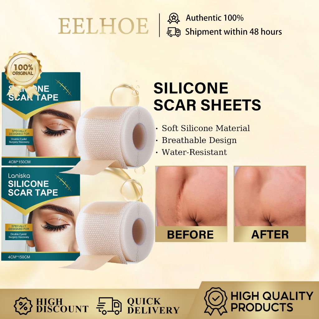 Folhas De Cicatriz De Silicone , Fita Para , Melhores Cicatrizes 4 * ...