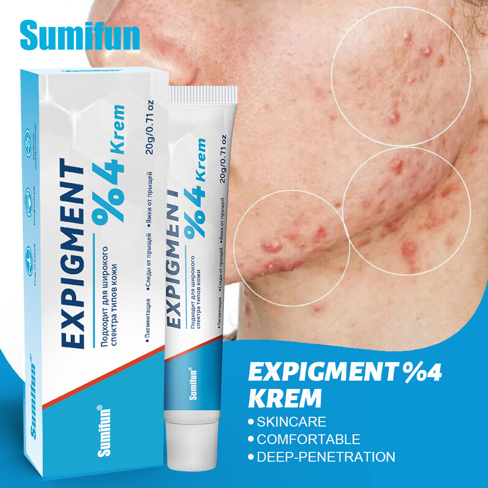 Creme para acne e cicatrizes – Tratamento eficaz para espinhas e marcas ...