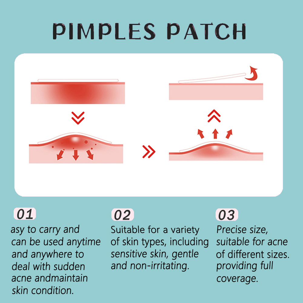Patch de Acne de Hidrocoloide 200PCS, Adesivo para Espinha Facial ...