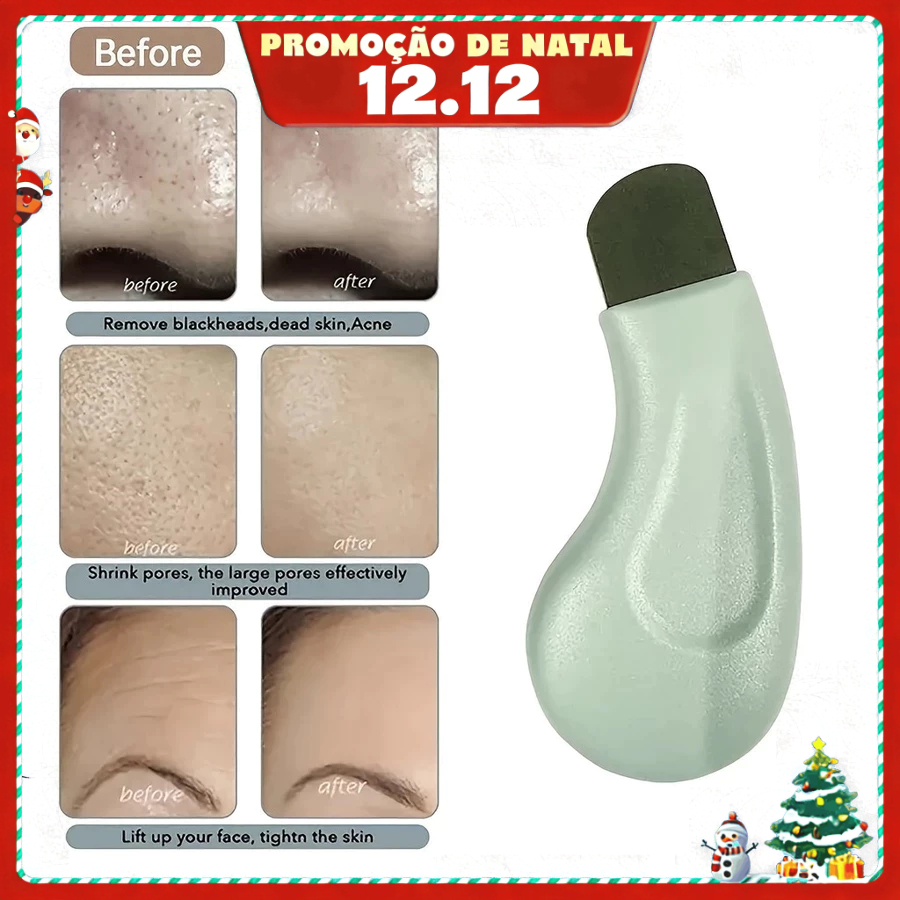 1 Pçs Profissional Nariz Limpeza Profunda Cravo Espinha Ferramenta De Remoção Rosto Esfoliante Espátula Poros Mais Limpo