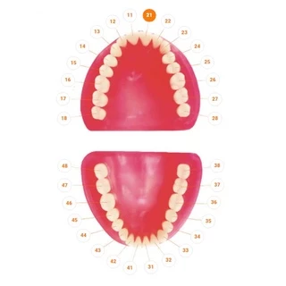 Dente 21 Dentística Avulso - Pronew