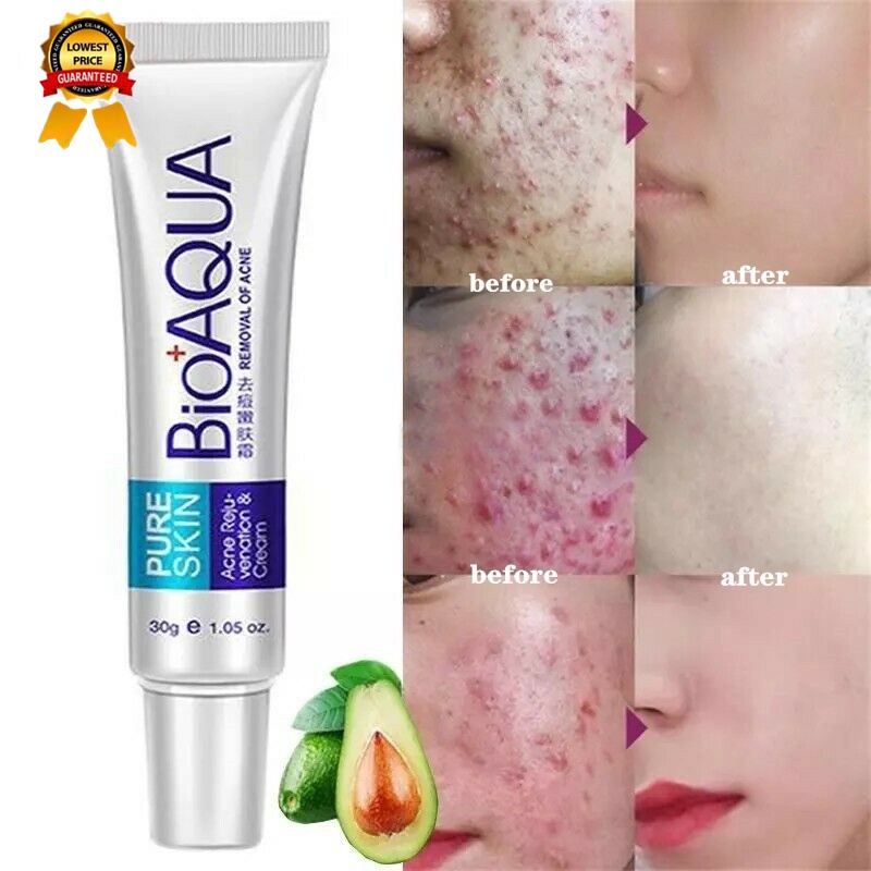 [Creme Facial Bioaqua 30g Clareador De Poros Abertos Controle De ...