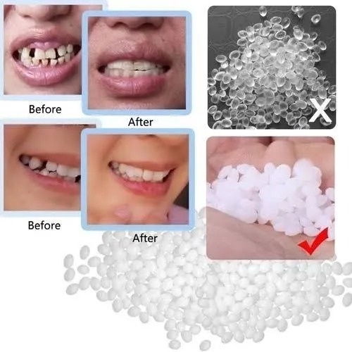 Massa Restauração Dente Provisório aproximadamente para + ou - 230 Bolinhas Massa