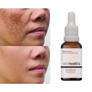 Sérum Multi Despigmentante Facial Clareador Ação Anti-idade