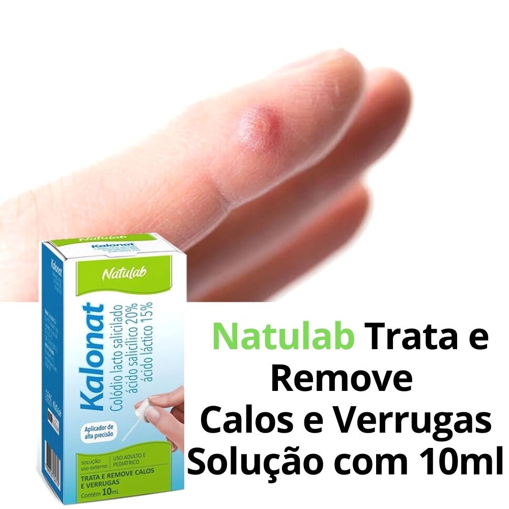 Trata e Remove Calo Verruga Olho de Peixe Calos Kalonat 10mL