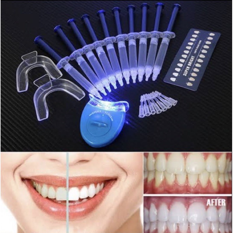 Gel Dental Profissional Clareador para Dentes Brancos LED/ Kit ...