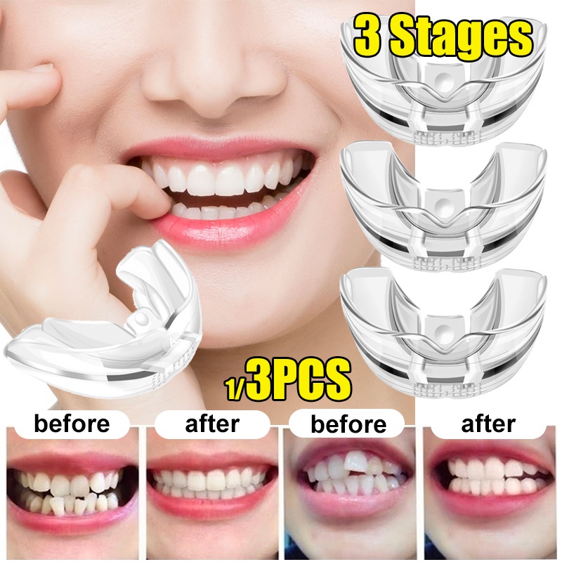 3pcs/set Dental Trainer Orthodontic Aparelho Alinhamento Material De Silicone Proteção Profissional TeethStraightener