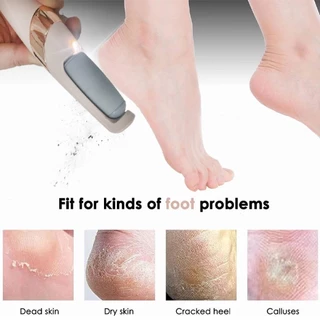 Lima Elétrica De Pés Removedor De Calos Ferramenta Pedicure Rolos Lixa Remoção De Pele Morta Cuidados Com O Moedor