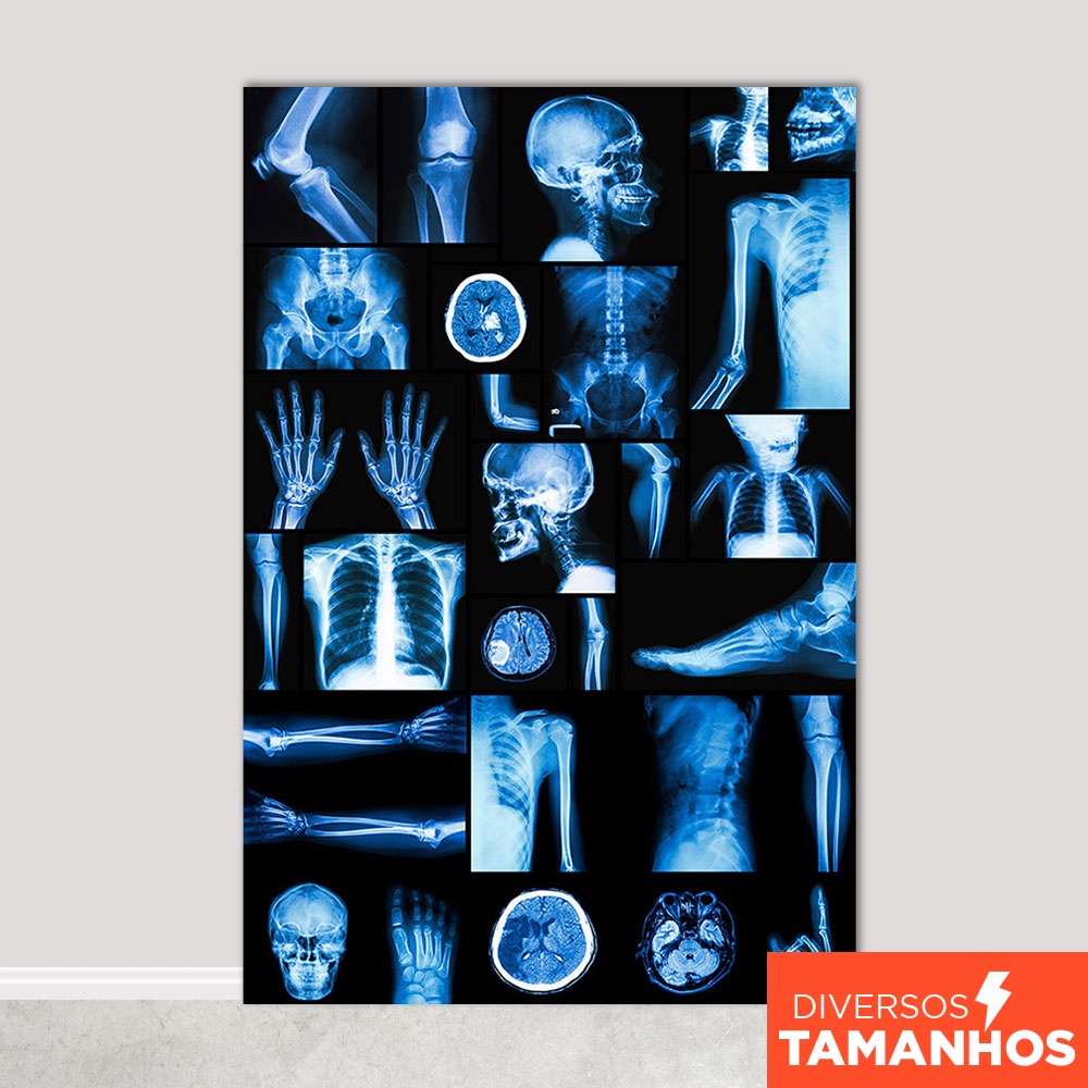 Fundo Fotográfico Formatura Medicina Raio-X Em Tecido FFB-481