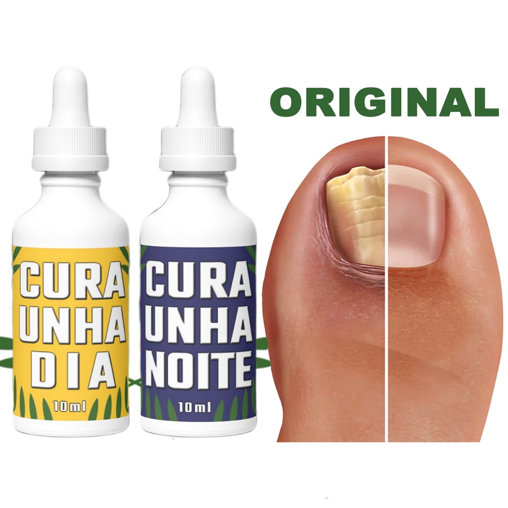 REMÉDIO NATURAL PARA UNHAS nails COM FUNGOS MICOSE UNHA VERDE UNHA ...