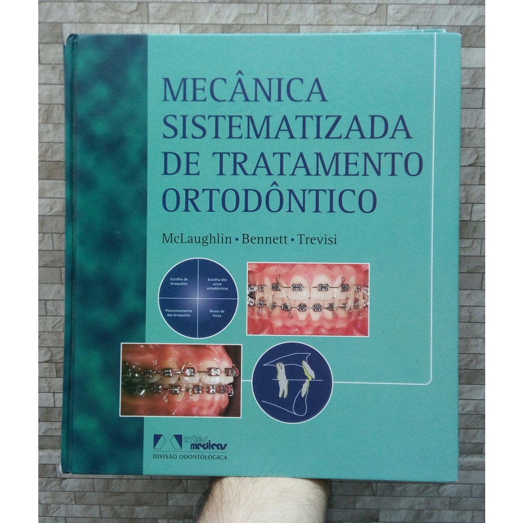 Livro Mecânica Sistematizada De Tratamento Ortodôntico - Mclaughlin ...