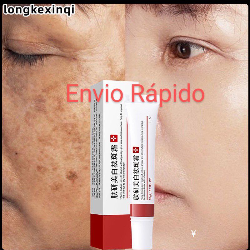 Creme Melasma Verdadeiro Original Pele Clarinha Brllhante