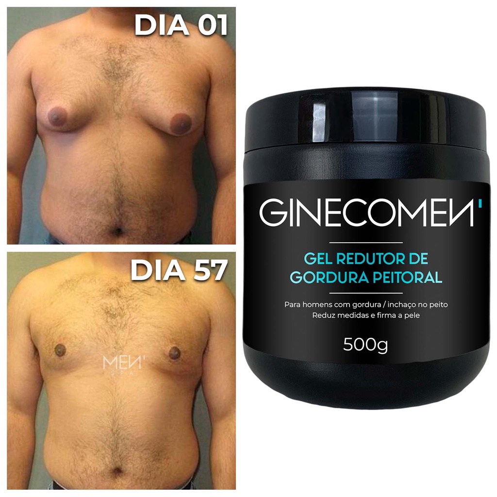 Ginecomen - 2un Tratamento para Redução de Ginecomastia 1kg