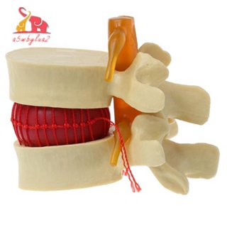 Modelo Lombar Vertebrae Anatômica Da Coluna Ferramenta De Ensino De Anatomia De Disco