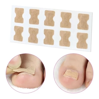 Kit 30 Adesivos Órtose Correção de Unhas Encravadas