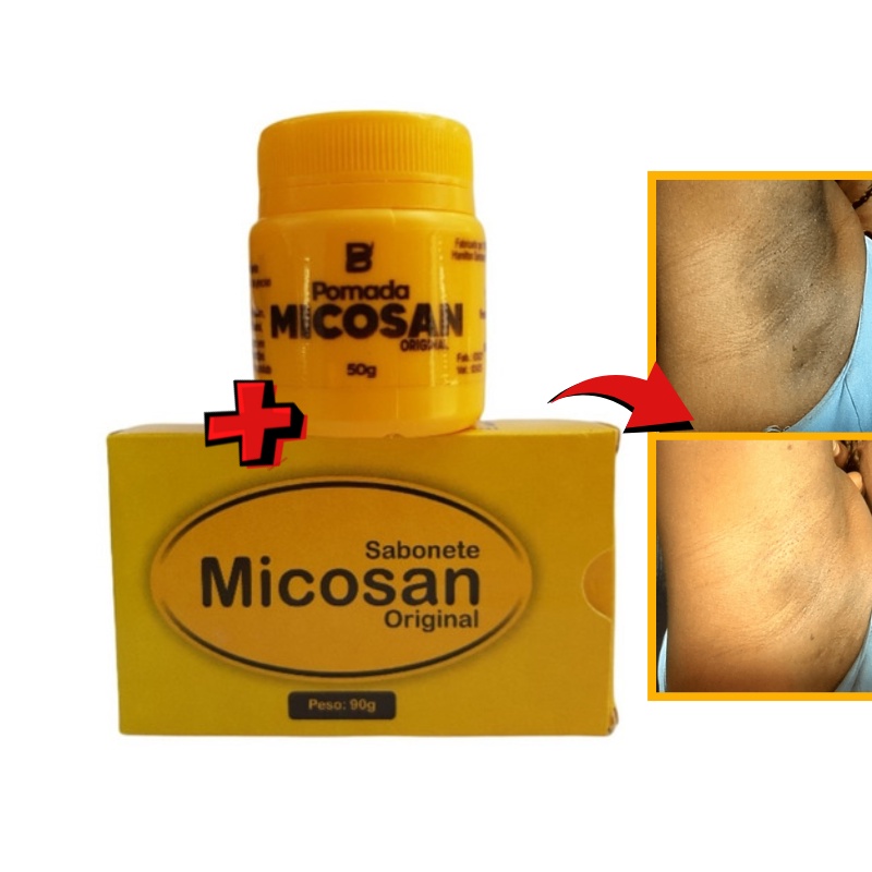 Kit (Com 2 Itens) POMADA Micosan + Sabonete em BARRA Micosan Original - Clareador de Manchas Promoção