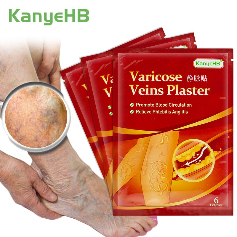 6 Peças Varizes patch/Remendo Venoso Para De | Shopee Brasil