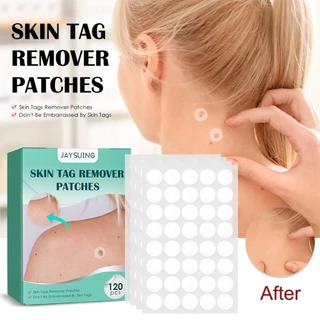 120 PCS Skin Tags Removedor De Etiquetas De Pele Para Suave E Saudável , Com Ingredientes Naturais