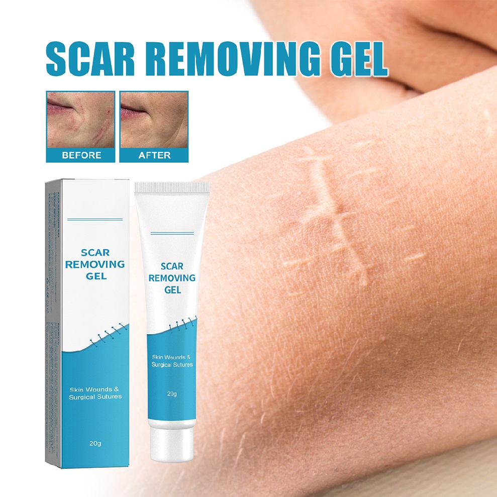 Scar Removing Gel Acne Scar Treatment Skin Wounds Surgical Scars Repair
