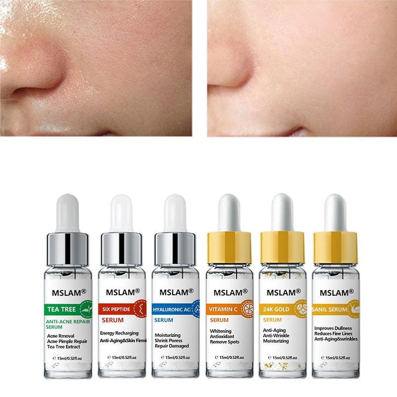 kit - Serum Mslam Melhora da Pele | Shopee Brasil