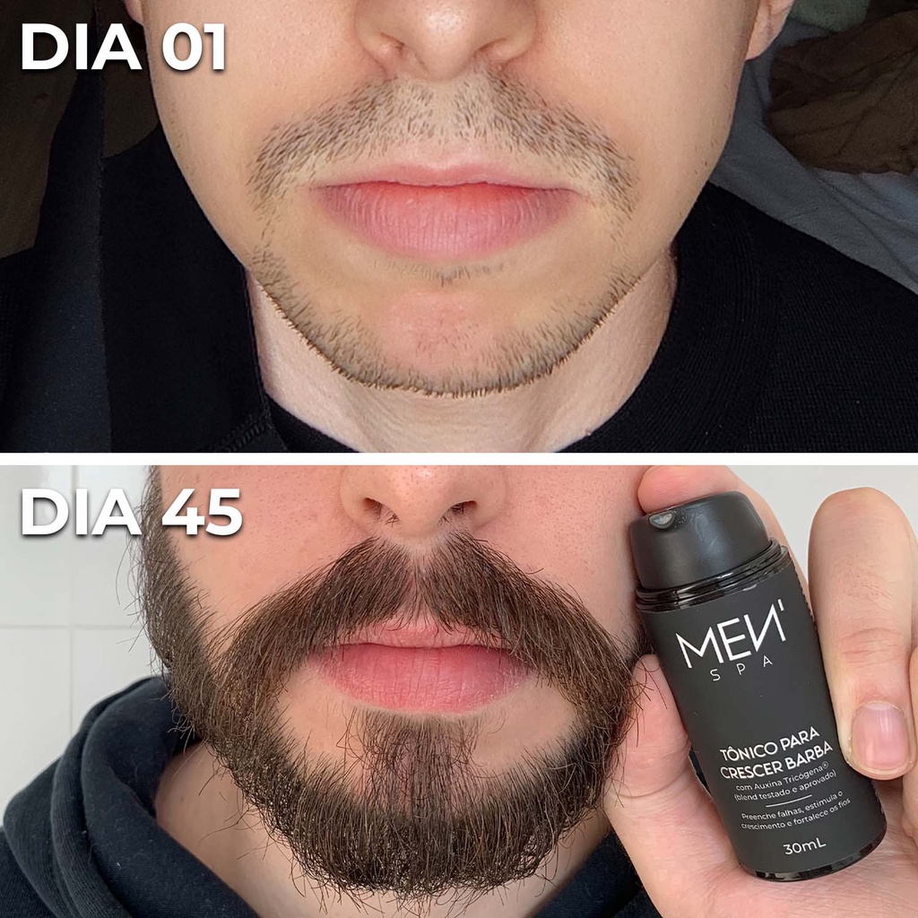 Kit 20 Tônico para Crescer Barba   Tratamento 20 Dias Menspa ...