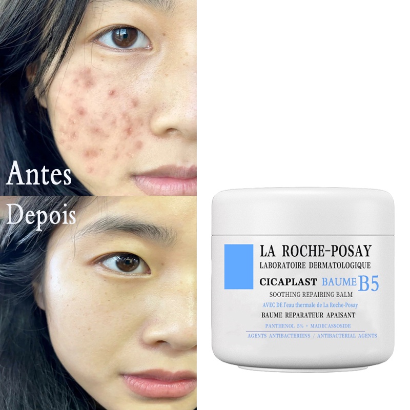 LA ROCHE-POSAY B5 Creme Para Acne/Hidratante/Ácido Salicílico/Manchas/Clareamento Da Pele 50ml